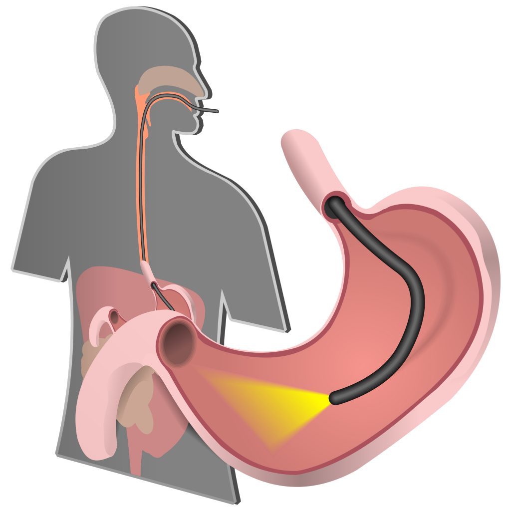 Endoscopia Digestiva Alta – Dra. Caroline Saad