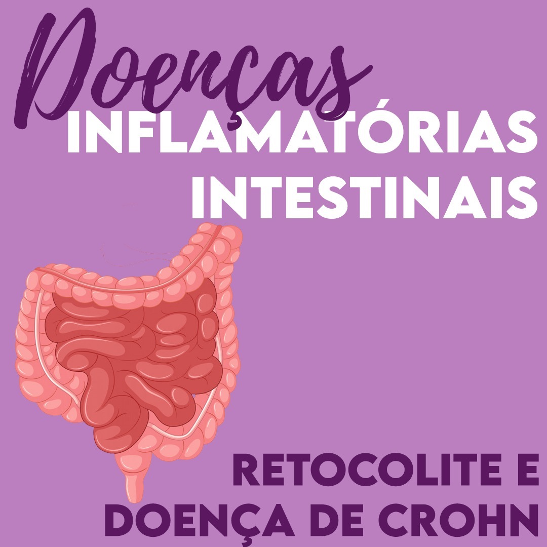 Doenças Inflamatórias Intestinais: Retocolite Ulcerativa e Doença de Crohn