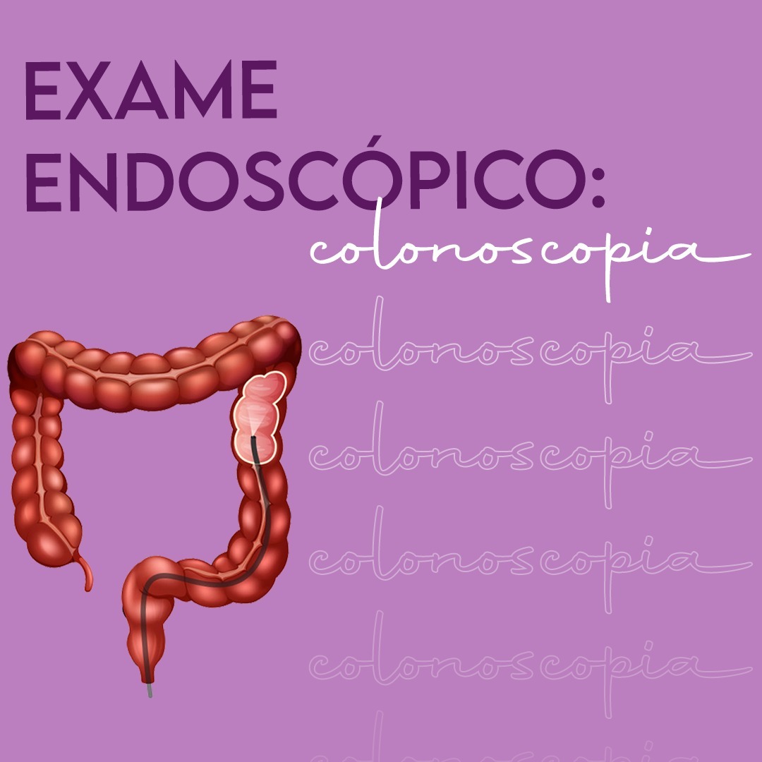 Colonoscopia