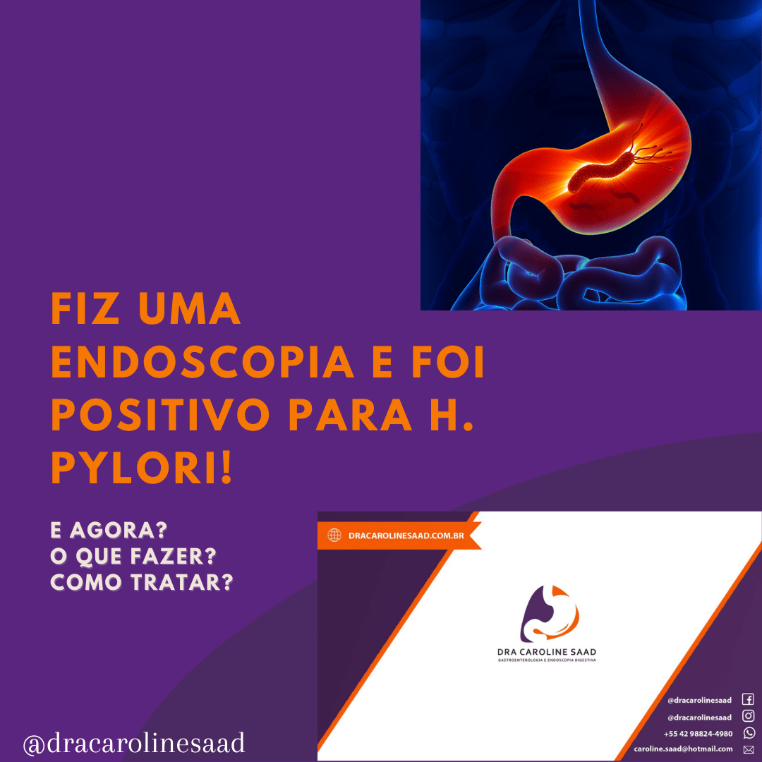 Fiz uma endoscopia e deu H Pylori